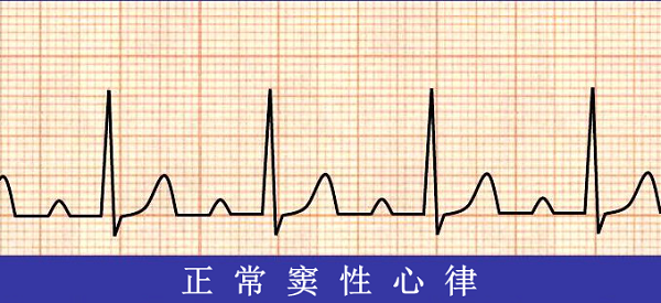 救命神器AED有多重要——你認識它嗎？(圖6)
